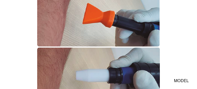 Blog 2 Freddo Tip Hose