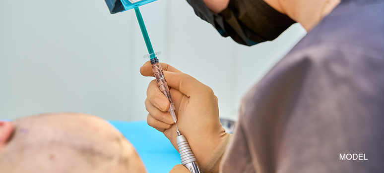 Follicular Unit Extraction