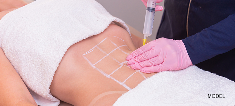Blog 10 Nano Fat Transfer