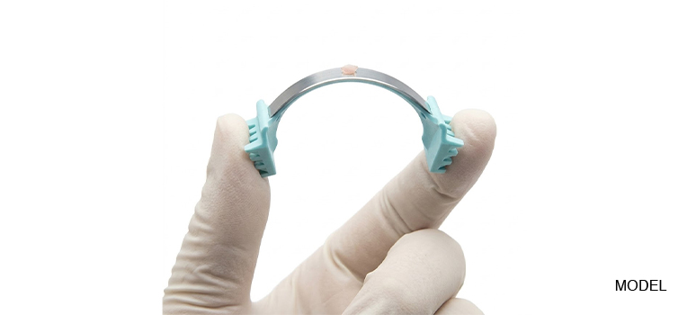 Shave Biopsy Houston